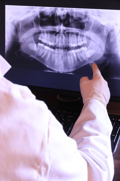 Best Emergency Gum Treatment in Long Lake, MN