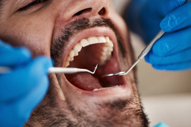 Best Emergency Dental Care for Broken or Chipped Teeth in Long Lake, MN